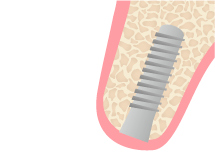 ステップ03 図