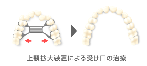 拡大装置による処置