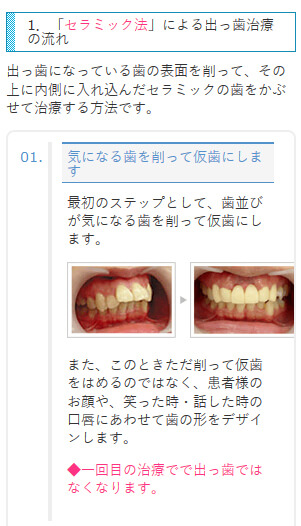 自力で出っ歯を治すデメリットと どんな出っ歯も可能な治療法 ザ ホワイトデンタルクリニック